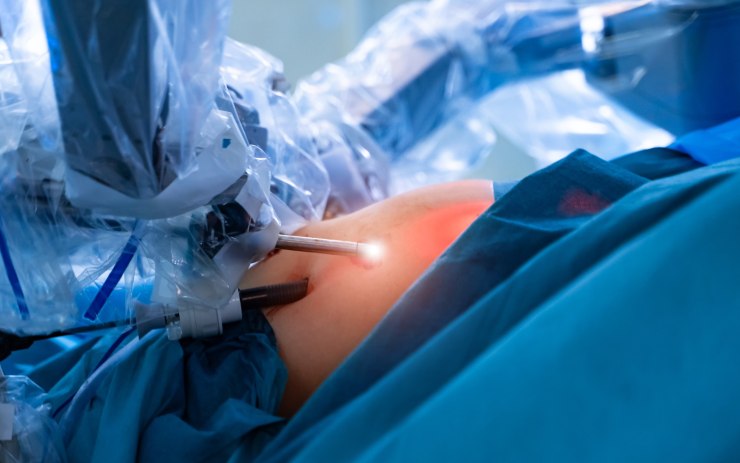 Chirurgia robotica, scena di un'operazione all'addome