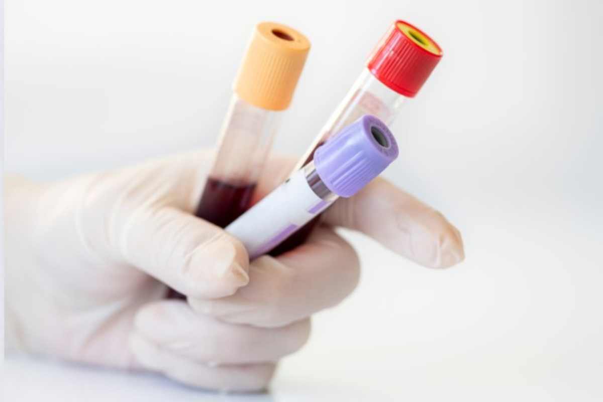 esame del sangue